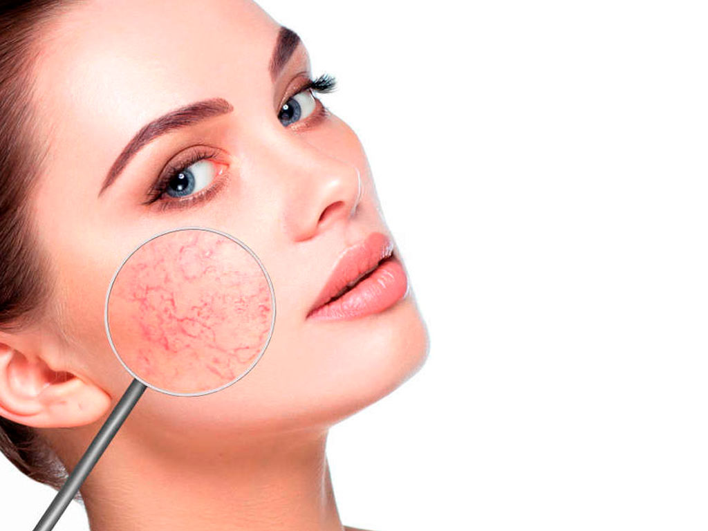 Oxygen Rx: veiksmingas aknės ir rožinės gydymas