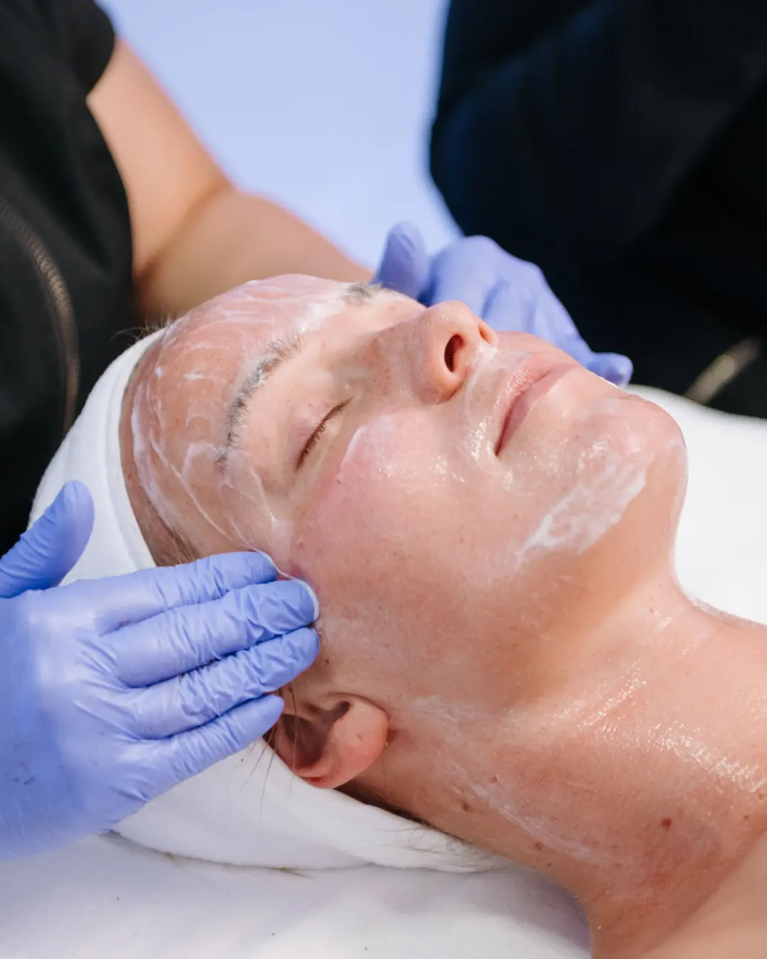 Deguonis kosmetologijoje